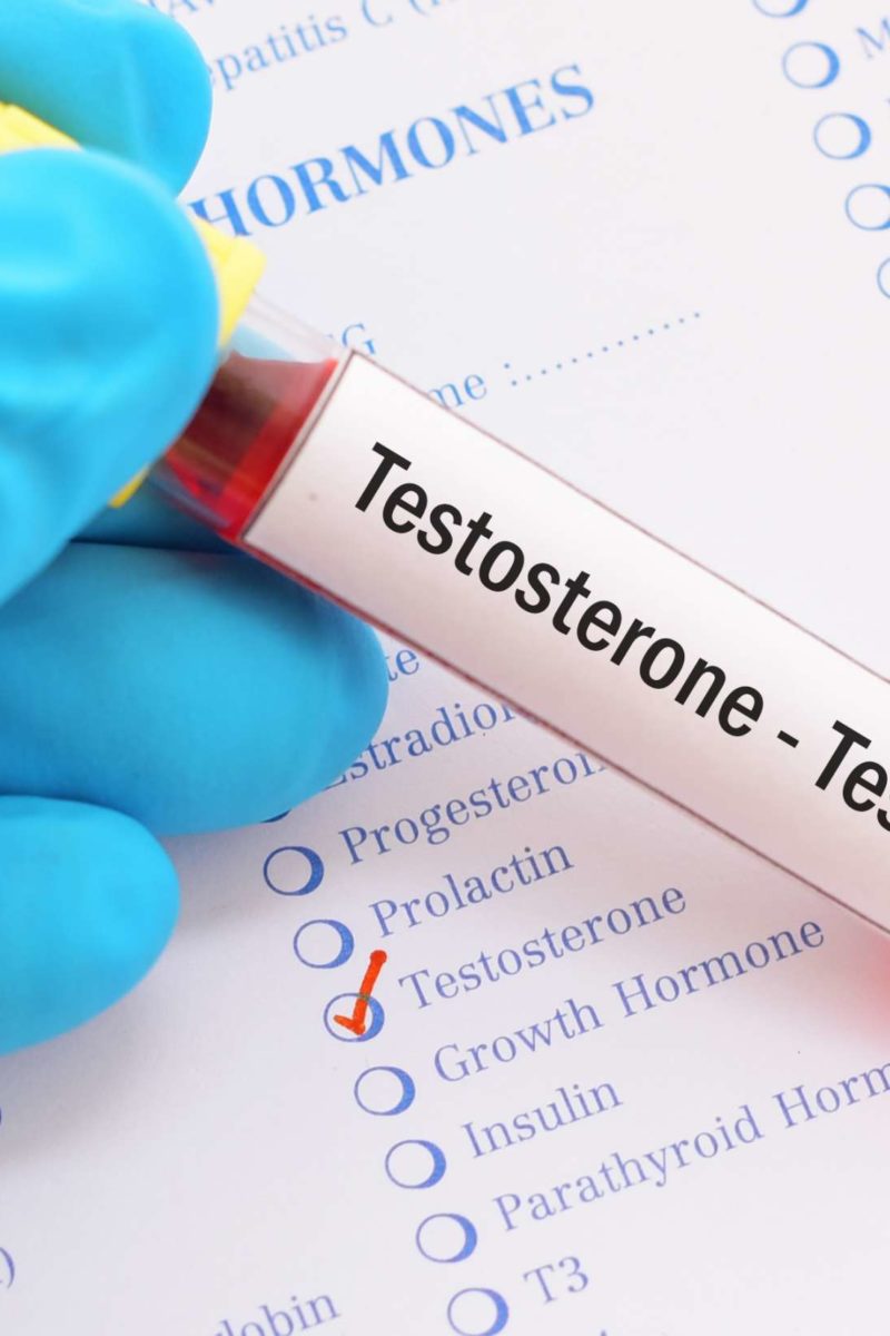 What Are Normal Testosterone Levels Ages Males Females And More