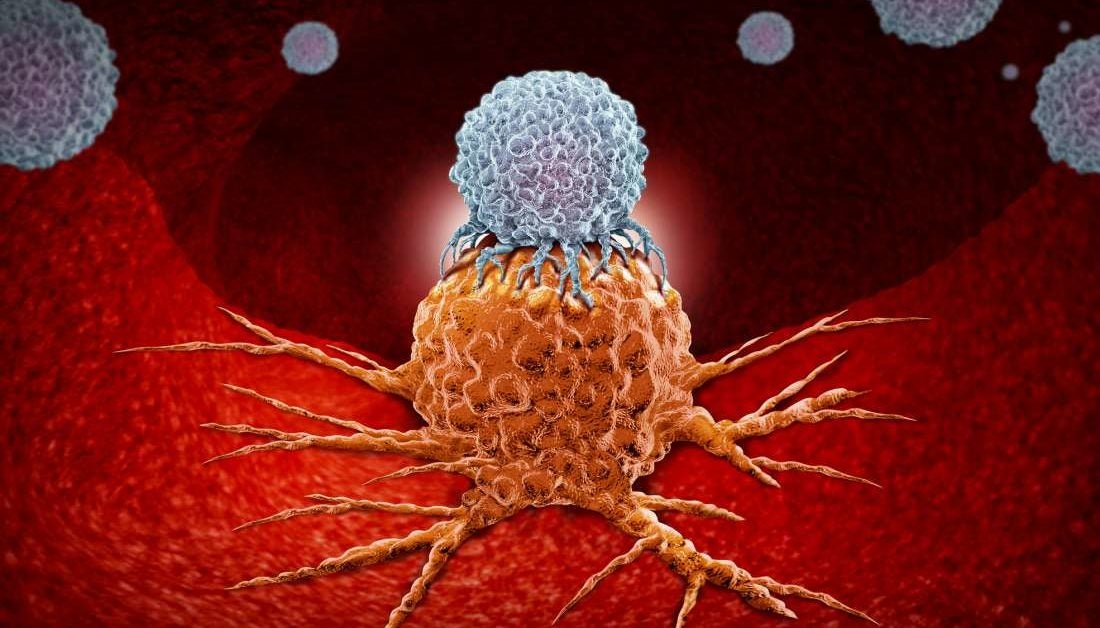 Immunotherapy 'Killer' cells get boost in fight against