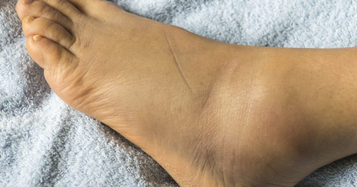 shoes for elderly man with swollen feet