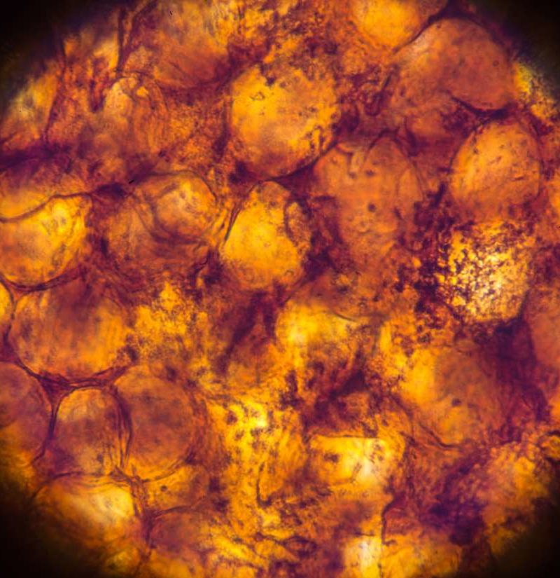 Diabetes Surprising New Role Of Fat Revealed