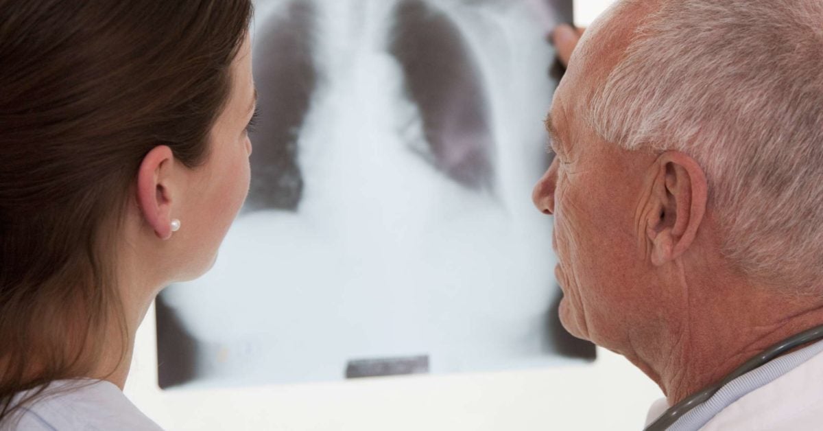 COPD Xray What it looks like and diagnosis