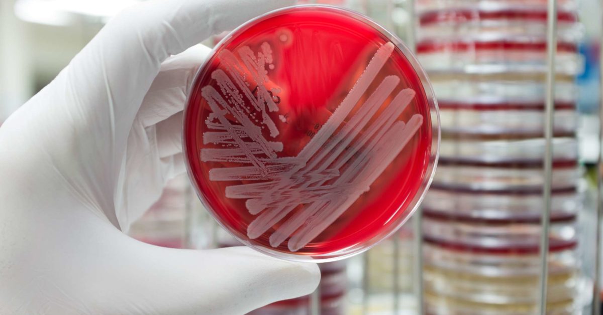 Antibiotic Resistance: Breakthrough Study Offers Solution