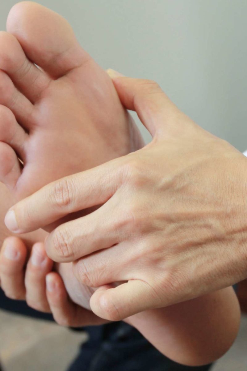 Bunion removal Surgery, recovery, and alternatives