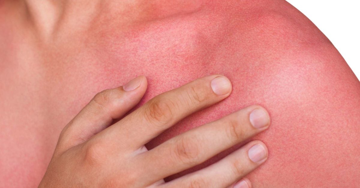 Skin redness Causes and when to see a doctor