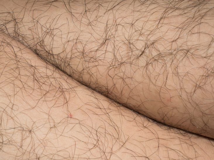 Hair removal: Types and how to choose