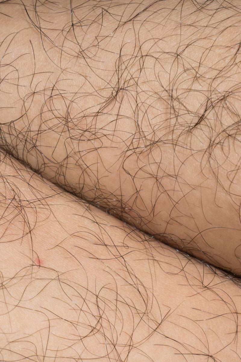 Qualified esthetician performing a belly hair removal Stock Photo by  Iakobchuk