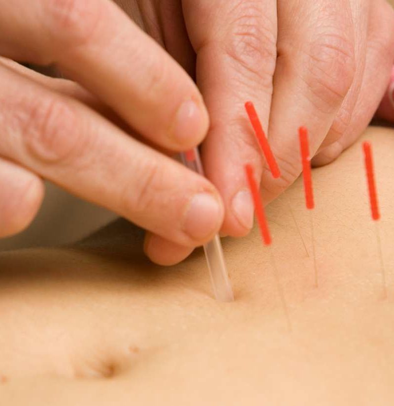 Acupuncture Rutherford, Wallington NJ - Wellness One of South Bergen