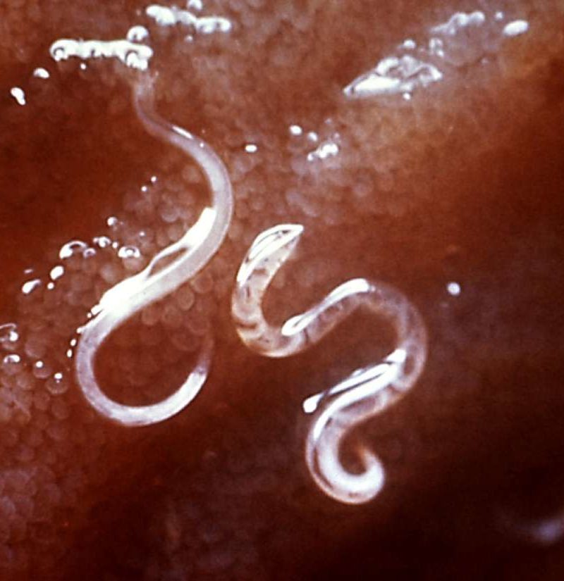 worms in human poop