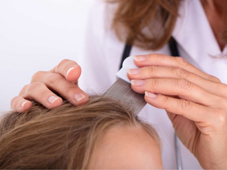 Does hair dye kill lice? Uses and more