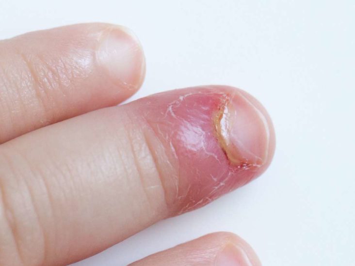 Why Do Acrylic Nails Hurt? | False Eyelashes