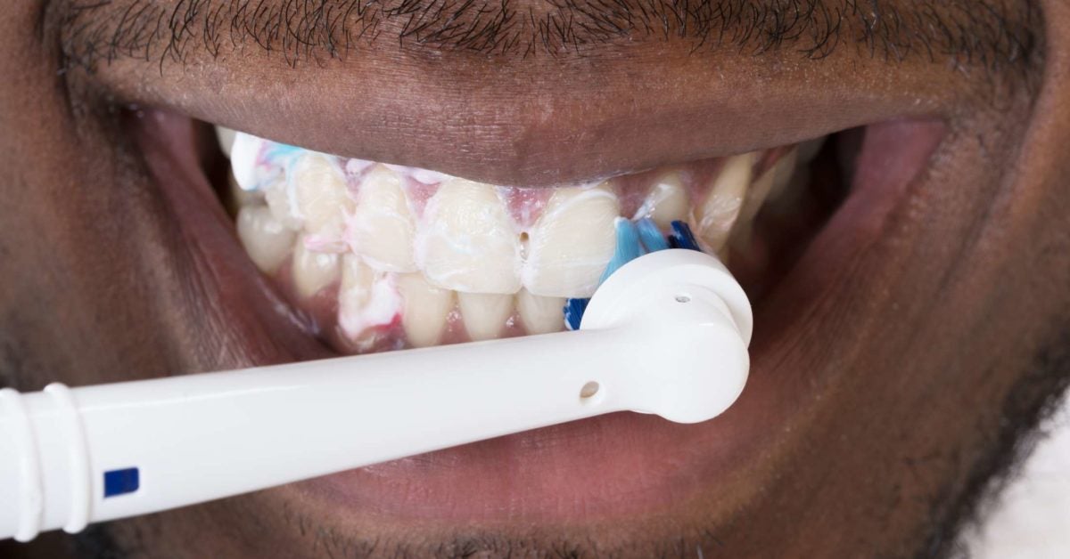 Can Brushing Teeth Reverse Tooth Decay? Discover the Power of Good Oral Hygiene!