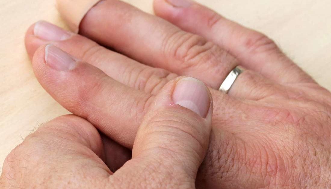 Finger pain: Causes, treatment, and self-care