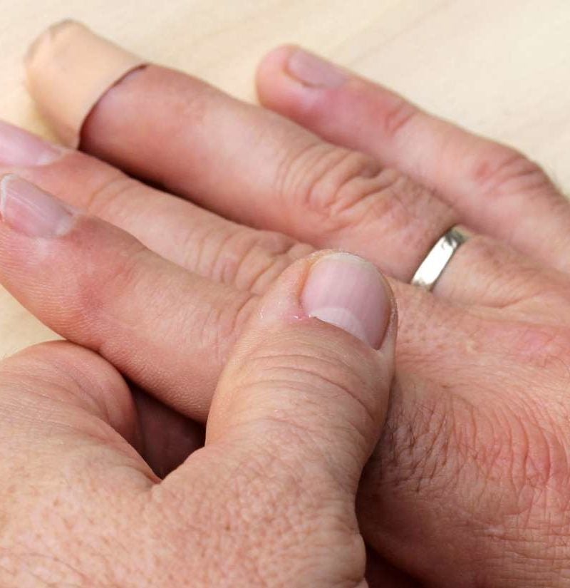 Finger pain Causes treatment and self care