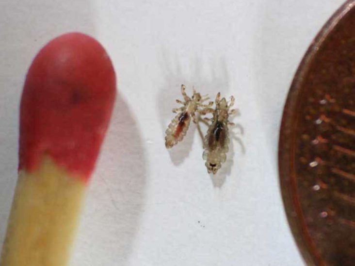 What do head lice look like? Symptoms and pictures