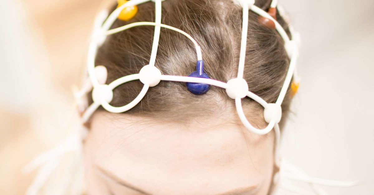 EEG electroencephalogram Test What To Know