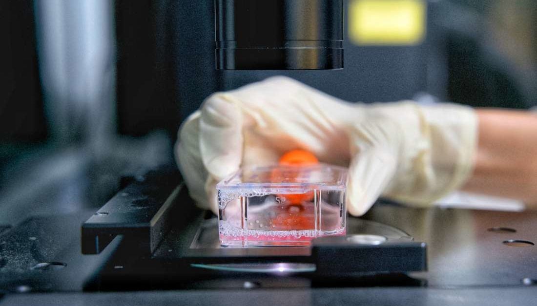 How vitamin D helps fight treatmentresistant cancer