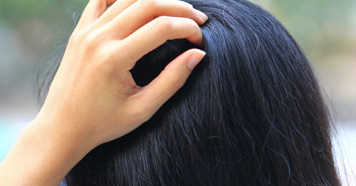 Tingling Scalp Causes Symptoms And Treatment