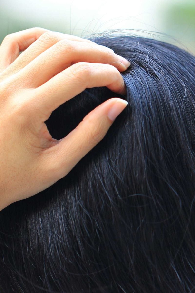 Tingling scalp: Causes, symptoms, and treatment