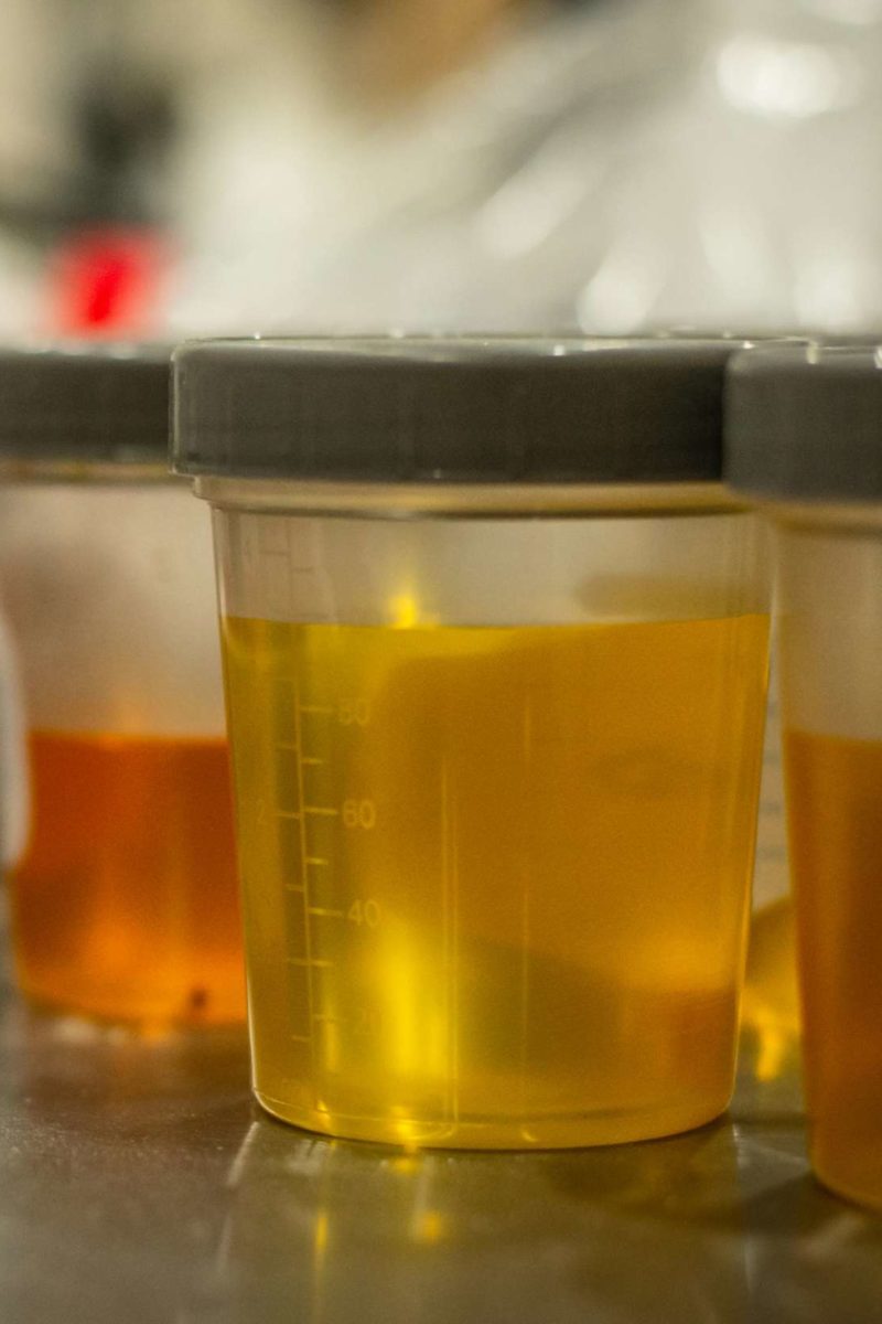 Urinalysis Tests, results, and more photo image