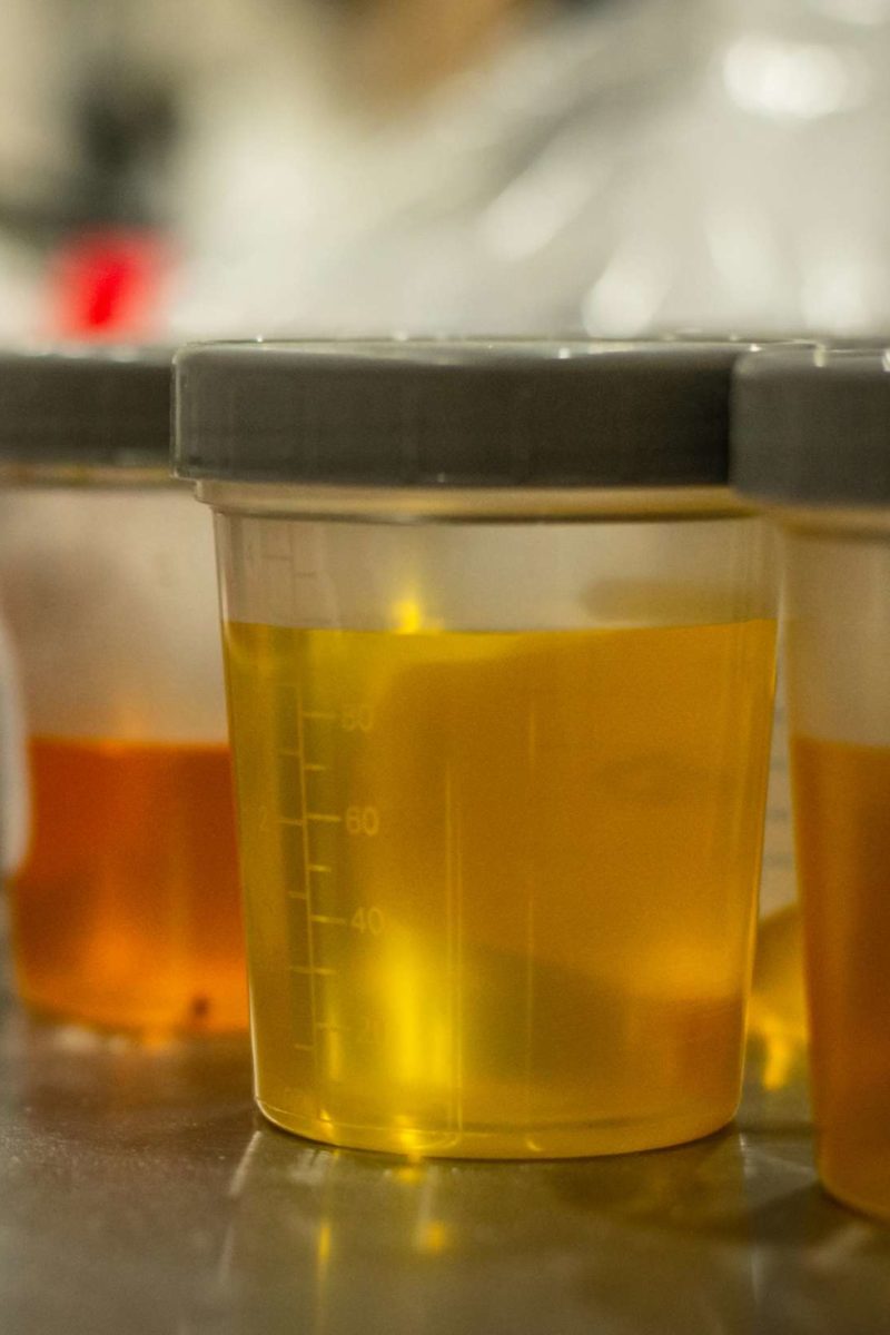 uti cloudy urine