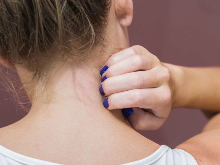 How to treat allergic reaction on neck