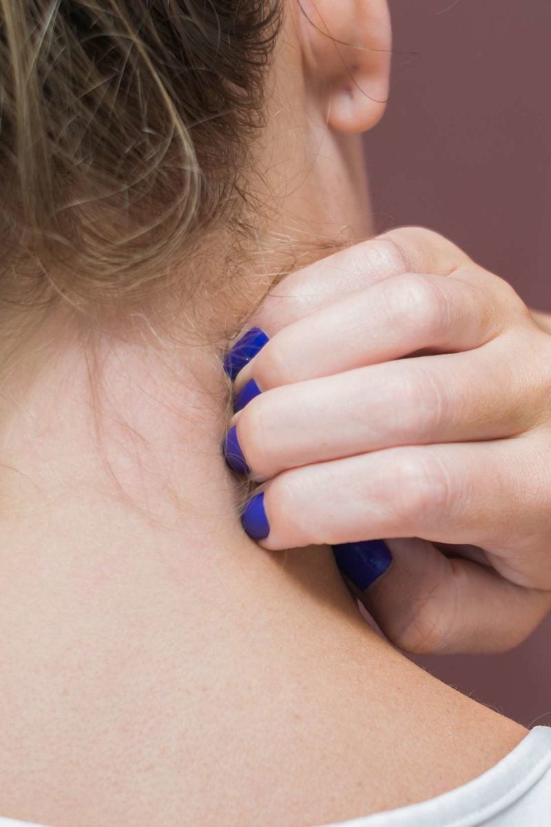 Red Spots On Neck After Shower