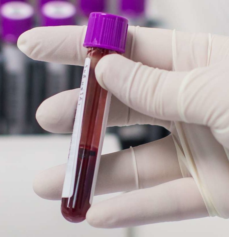 What Is Most Rare Blood Type