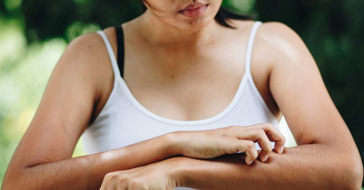 性器乾癬は性感染症ですか?