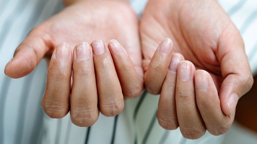 9 Ways to Stop Biting Your Nails Once and for All - How to Stop Biting Your  Nails
