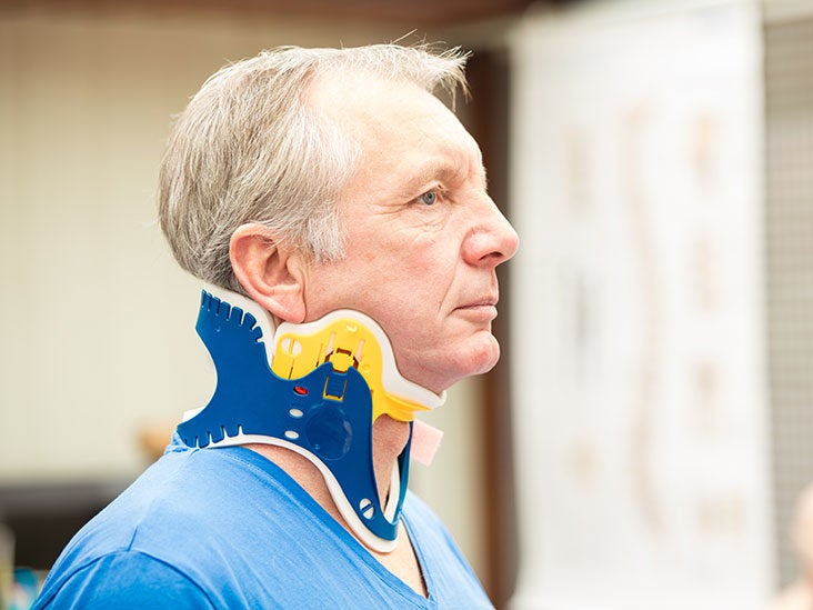 Myths about Cervical Collars after Neck Surgery