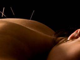 Charlotte Acupuncture Clinic