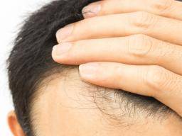 Biotin for hair growth: Dosage and side effects