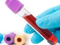 Type 2 diabetes risk may be influenced by blood type