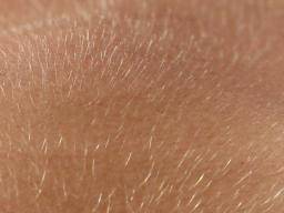Health Guide - WHAT CAUSES EXCESS SECRETION OF HAIRS IN FEMALE Hirsutism is  a condition of unwanted, male-pattern hair growth in women. Hirsutism  results in excessive amounts of dark, course hair on