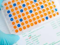 western blot vs elisa hiv