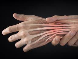 Extensor tendonitis: Causes, recovery, and prevention