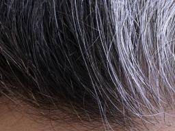 Premature White hair 6 reason and its Solution | आज से बाल जल्दी सफेद नही  होगा - YouTube