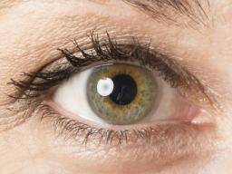 Central heterochromia (two different eye colors): Causes and types