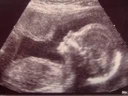 baby boy in womb