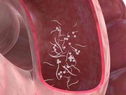 Pinworms a belekben, Enterobiasis - a pinworms aktivitásának következménye