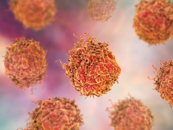 Prostate cancer: How immune cells promote tumor growth