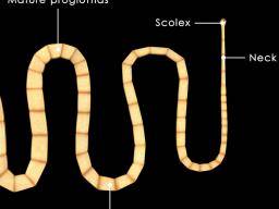 mi a pinworm roundworm)