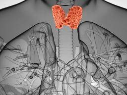 Hashimoto S Thyroiditis Symptoms Causes And Diagnosis