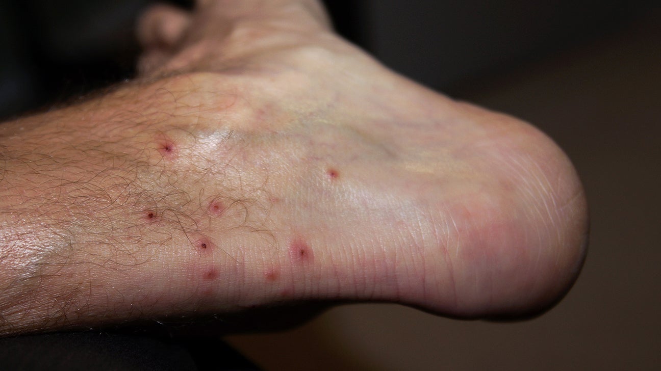 what do gnat bites look like on a dog