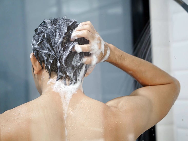 Ketoconazole shampoo: Benefits, side effects, and more