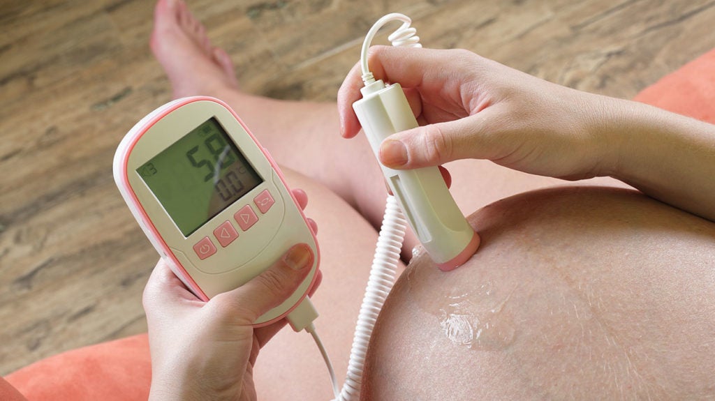 doppler ultrasound pregnancy cost