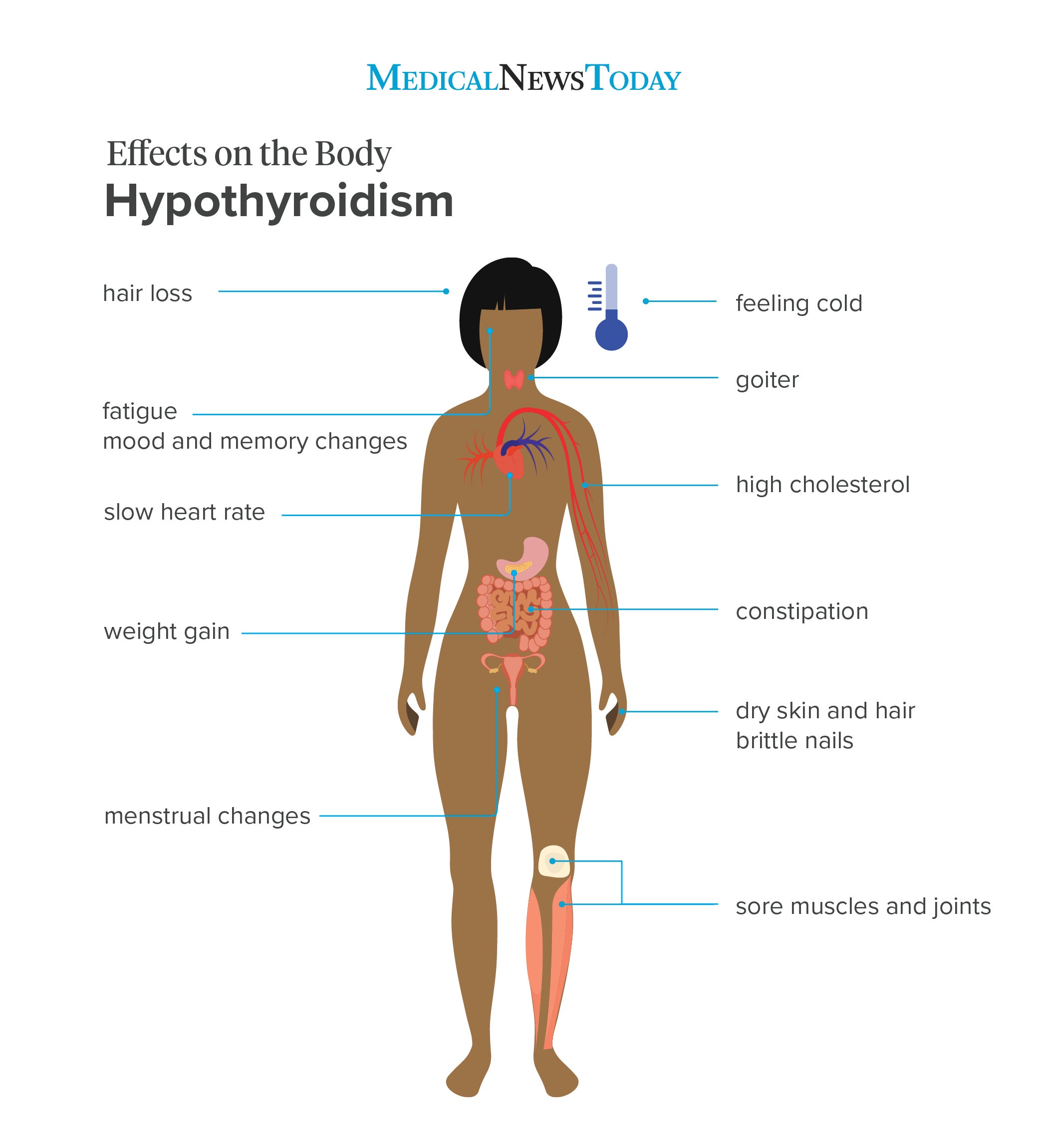 Symptoms of Hypothyroidism underactive thyroid