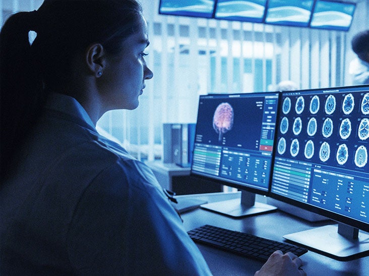 Stroke: Causes, symptoms, diagnosis, and treatment