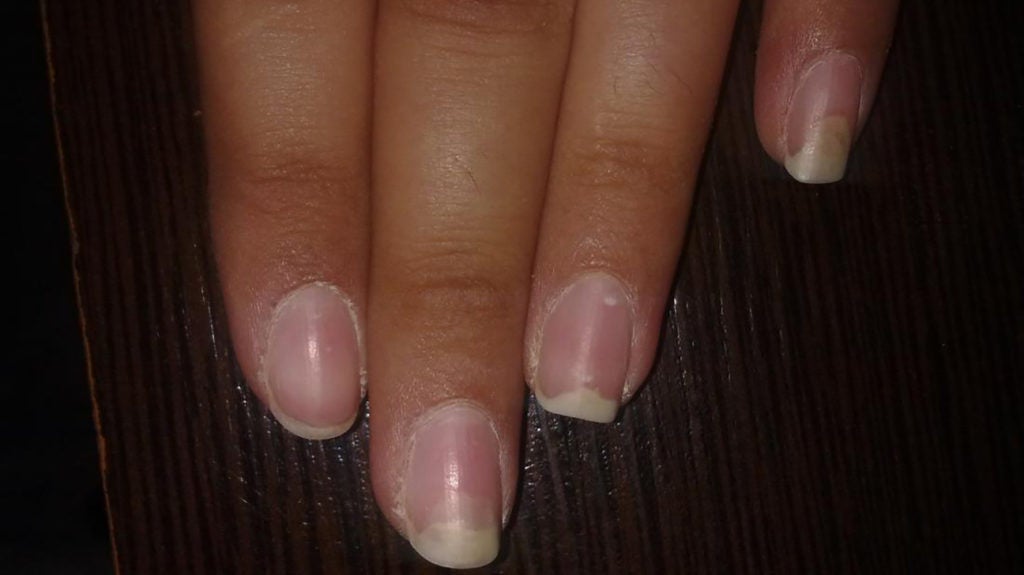 My nail just popped off! - Nail Divas