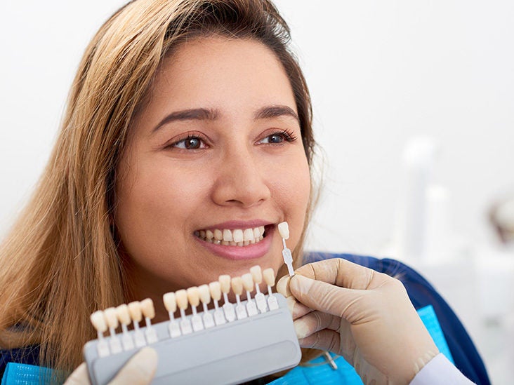 Dental veneers: Cost, procedure, and results